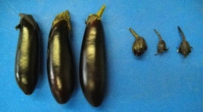 ���󕲁i�������������j�̉ʎ��̒P�׌��ʓˑR�ψف�4�n���uPCSS�v�i���j�A��P�׌���F1�i��u�痼�񍆁v�i�E�j�̔�r�B�i�ʐ^�񋟁F�_���@�\�j