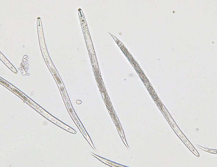 シストセンチュウの2期幼虫（写真：著者）